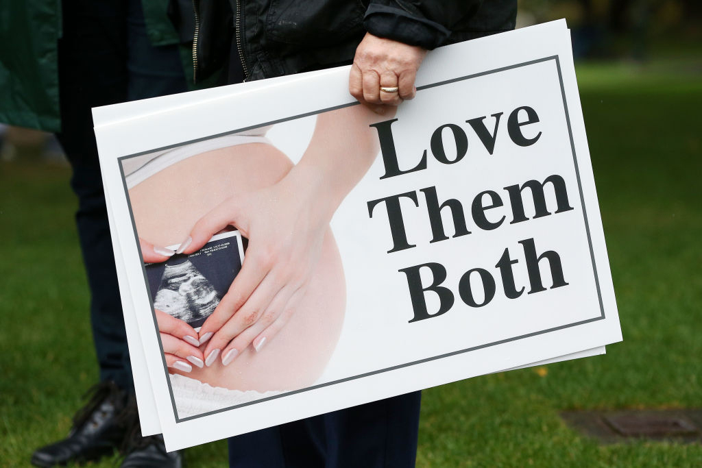 Líderes da Igreja alertam sobre o aumento recorde de 55% nos abortos na Escócia