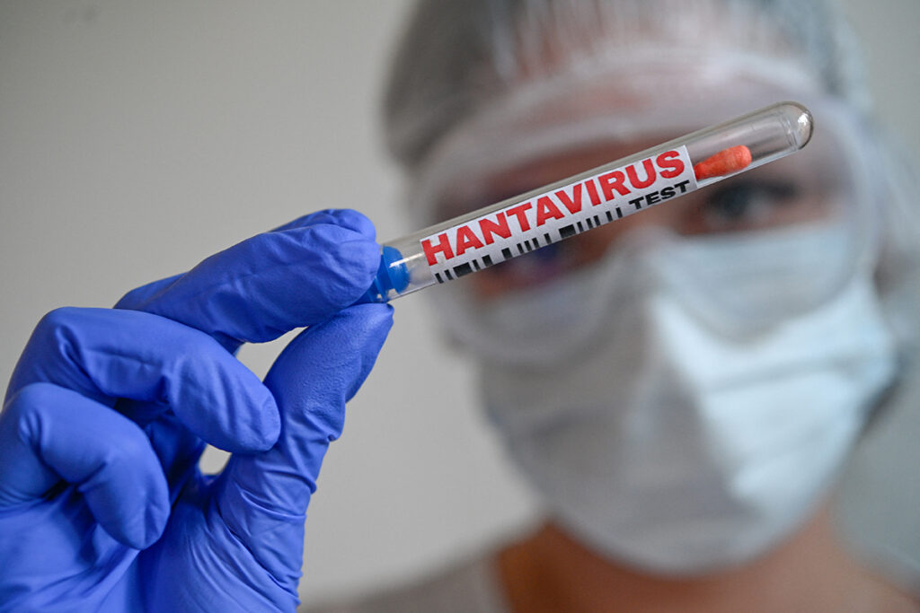 Surto de cruzeiro por hantavírus: 5 fatos críticos que você precisa saber