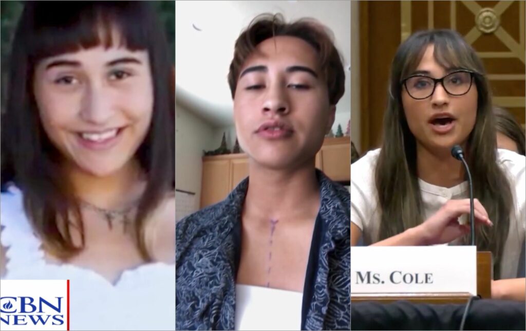 Mulher ex trans na adolescência relata traumas e arrependimento